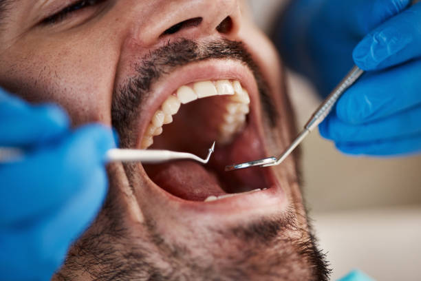 Best Emergency Tooth Extraction in Powells Crossroads, TN