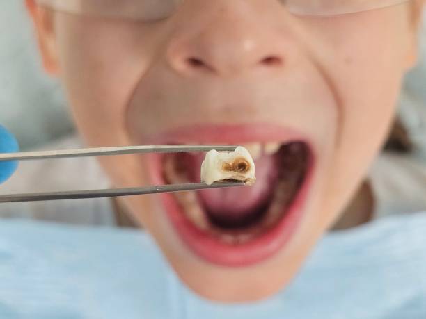 Best Pediatric Emergency Dentist in Powells Crossroads, TN